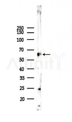 IL-2RA/CD25 Recombinant Rabbit mAb - Western blot analysis of lysates from HepG2 cells(heat-shock,45min treatment), using IL-2 Receptor alpha Rabbit mAb at 1/1000 dilution.
