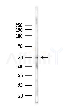 FCGR1A Recombinant Rabbit mAb - Western blot analysis of lysates from B16F10-LUC cells(LPS 4h treatment), using FCGR1A Recombinant Rabbit mAb at 1/1000 dilution.