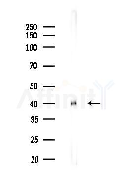 Glutamine Synthetase Recombinant Rabbit mAb - Western blot analysis of lysates from Mouse kidney, using Glutamine Synthetase Rabbit mAb at 1/1000 dilution.