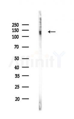 IFNAR1 Recombinant Rabbit mAb - Western blot analysis of lysates from Hela cells(LPS,4h treatment), using Interferon alpha/beta Receptor 1 Recombinant Rabbit mAb at 1/1000 dilution.