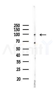 GluR2 Recombinant Rabbit mAb - Western blot analysis of lysates from COLO205 cells(LPS, 4h treatment), using Ionotropic Glutamate Receptor 2 Recombinant Rabbit mAb at 1/1000 dilution.