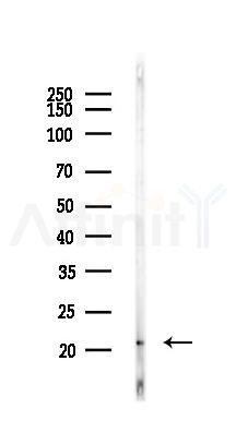 RAP1A Recombinant Rabbit mAb - Western blot analysis of lysates from Rat spleen, using RAP1A/RAP1B Recombinant Rabbit mAb at 1/1000 dilution.