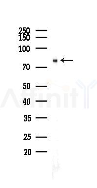 SMURF2 Recombinant Rabbit mAb - Western blot analysis of lysates from HUVEC cells(heat-shock 45min treatment), using SMURF 2 Recombinant Rabbit mAb at 1/1000 dilution.