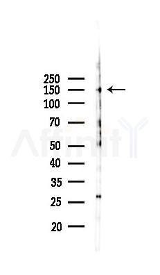 IRS2 Recombinant Rabbit mAb - Western blot analysis of lysates from Mouse brain, using IRS2 Recombinant Rabbit mAb at 1/1000 dilution.
