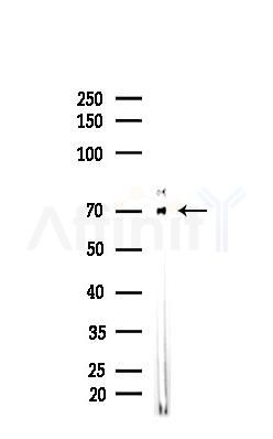 NGFR Recombinant Rabbit mAb - Western blot analysis of lysates from 293 cells(heat-shock,45min treatment), using p75 NGF Receptor Recombinant Rabbit mAb at 1/1000 dilution.