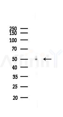 ETS1 Recombinant Rabbit mAb - Western blot analysis of lysates from EC304 cells(LPS, 4h treatment), using ETS1 Recombinant Rabbit mAb at 1/1000 dilution.