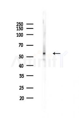 MMP8 Recombinant Rabbit mAb - Western blot analysis of lysates from A375 cells(heat-shock,45min treatment), using MMP8 Rabbit mAb at 1/1000 dilution.