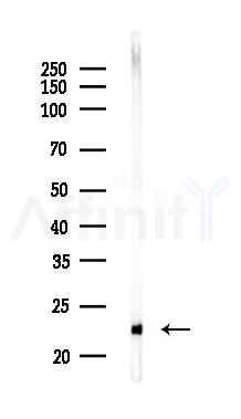 RAB7 Recombinant Rabbit mAb - Western blot analysis of lysates from Hela cells(LPS,4h treatment), using Rab7 Recombinant Rabbit mAb at 1/1000 dilution.