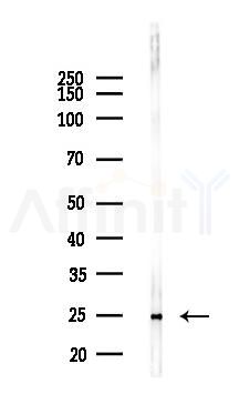 RAB7 Recombinant Rabbit mAb - Western blot analysis of lysates from Mouse liver, using Rab7 Recombinant Rabbit mAb at 1/1000 dilution.
