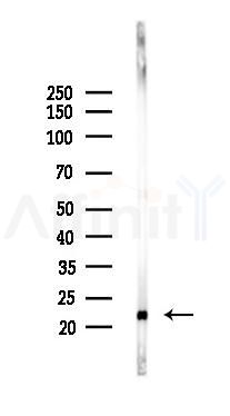 RAB7 Recombinant Rabbit mAb - Western blot analysis of lysates from HUVEC cells(LPS,4h treatment), using Rab7 Recombinant Rabbit mAb at 1/1000 dilution.