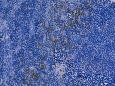 RAB7 Recombinant Rabbit mAb - BF3749 at 1/100 staining human normal tonsil tissue by IHC-P.