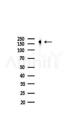 HER4 Recombinant Rabbit mAb - Western blot analysis of lysates from B16F10-LUC cells(starvation,24h treatment), using ErbB 4 Recombinant Rabbit mAb at 1/1000 dilution.