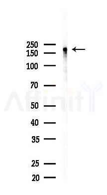 HER4 Recombinant Rabbit mAb - Western blot analysis of lysates from Hela cells(starvation,24h treatment), using ErbB 4 Recombinant Rabbit mAb at 1/1000 dilution.