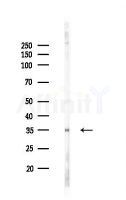 TRADD Recombinant Rabbit mAb - Western blot analysis of lysates from Hela cells(LPS,4h treatment), using TRADD Recombinant Rabbit mAb at 1/1000 dilution.