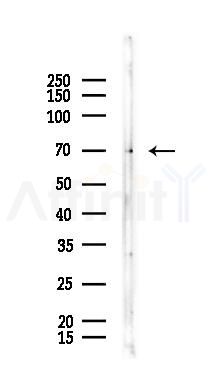 Integrin alpha4 Recombinant Rabbit mAb - Western blot analysis of lysates from Rat muscle, using Integrin alpha 4/CD49D Recombinant Rabbit mAb at 1/1000 dilution.