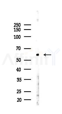 SSTR2 Recombinant Rabbit mAb - Western blot analysis of lysates from HUVEC cells(starvation,24h treatment), using Somatostatin Receptor 2 Recombinant Rabbit mAb at 1/1000 dilution.