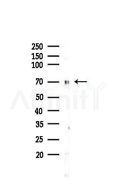 FOXC1 Recombinant Rabbit mAb - Western blot analysis of lysates from HUVEC cells(LPS,4h treatment), using FOXC1 Recombinant Rabbit mAb at 1/1000 dilution.