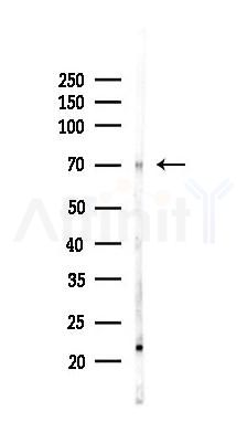 FOXC1 Recombinant Rabbit mAb - Western blot analysis of lysates from Rat kidney, using FOXC1 Recombinant Rabbit mAb at 1/1000 dilution.