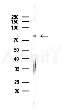 CREB Regulated Transcription Coactivator 2 Recombinant Rabbit mAb - Western blot analysis of lysates from B16F10-LUC cells(LPS, 4h treatment), using CREB Regulated Transcription Coactivator 2 Recombinant Rabbit mAb at 1/1000 dilution.