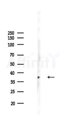 AurB Recombinant Rabbit mAb - Western blot analysis of lysates from COLO205 cells(LPS,4h treatment), using Aurora B Recombinant Rabbit mAb at 1/1000 dilution.