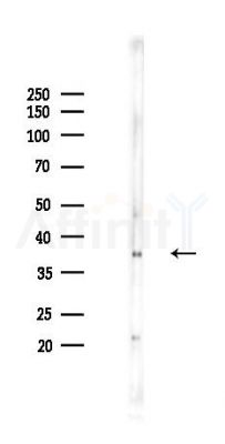 AurB Recombinant Rabbit mAb - Western blot analysis of lysates from HepG2 cells(heat-shock,45min treatment), using Aurora B Recombinant Rabbit mAb at 1/1000 dilution.