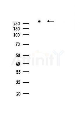 WNK1 Recombinant Rabbit mAb - Western blot analysis of lysates from Hela cells(LPS,4h treatment), using WNK1 Recombinant Rabbit mAb at 1/1000 dilution.