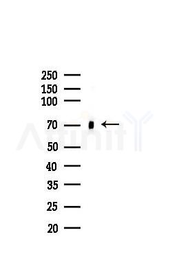 IGF2BP1 Recombinant Rabbit mAb - Western blot analysis of lysates from HUVEC cells(LPS,4h treatment), using IGF2BP1 Recombinant Rabbit mAb at 1/1000 dilution.
