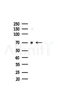 IGF2BP1 Recombinant Rabbit mAb - Western blot analysis of lysates from COLO205 cells(heat-shock,45min treatment), using IGF2BP1 Recombinant Rabbit mAb at 1/1000 dilution.