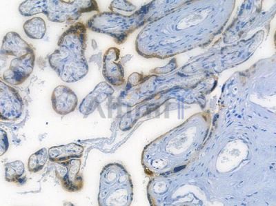 IGF2BP1 Recombinant Rabbit mAb - BF3775 at 1/100 staining human normal placenta tissue by IHC-P.