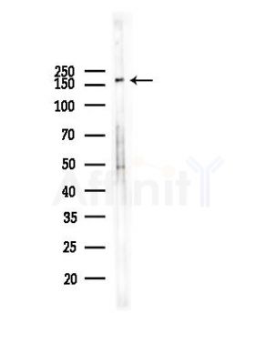 MRC2 Recombinant Rabbit mAb - Western blot analysis of lysates from HepG2 cells(heat-shock,45min treatment), using MRC2 Rabbit mAb at 1/1000 dilution.