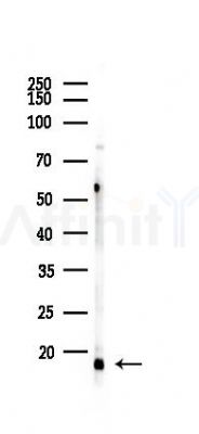 PGE synthase Recombinant Rabbit mAb - Western blot analysis of lysates from Hela cells(LPS,4h treatment), using Prostaglandin E Synthase Recombinant Rabbit mAb at 1/1000 dilution.