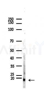 PGE synthase Recombinant Rabbit mAb - Western blot analysis of lysates from Rat testis, using Prostaglandin E Synthase Recombinant Rabbit mAb at 1/1000 dilution.