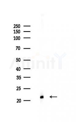 Cytochrome c Oxidase 2 Recombinant Rabbit mAb - Western blot analysis of lysates from Hela cells(LPS,4h treatment), using MTCO2 Recombinant Rabbit mAb at 1/1000 dilution.