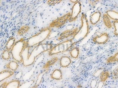Cytochrome c Oxidase 2 Recombinant Rabbit mAb - BF3778 at 1/100 staining human normal colon tissue by IHC-P.