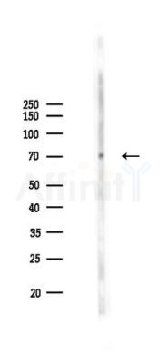 THRB Recombinant Rabbit mAb - Western blot analysis of lysates from COLO205 cells(UV 30min treatment), using Prothrombin Recombinant Rabbit mAb at 1/1000 dilution.