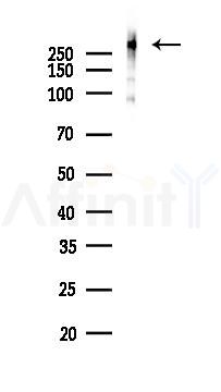 Filamin A Recombinant Rabbit mAb - Western blot analysis of lysates from Mouse liver, using Filamin A Recombinant Rabbit mAb at 1/1000 dilution.