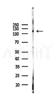 ITGA6 Recombinant Rabbit mAb - Western blot analysis of lysates from Rat lung, using Integrin alpha 6 Recombinant Rabbit mAb at 1/1000 dilution.