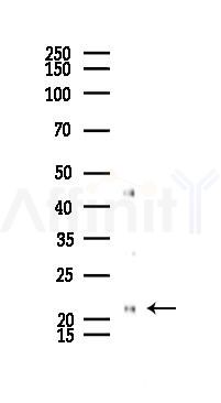 BID Recombinant Rabbit mAb - Western blot analysis of lysates from LoVo cells(heat-shock,45min treatment), using Bid Recombinant Rabbit mAb at 1/1000 dilution.
