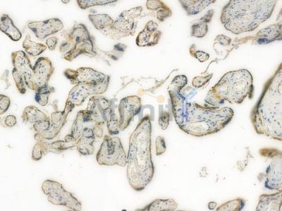 BID Recombinant Rabbit mAb - BF3789 at 1/100 staining human normal placenta tissue by IHC-P.