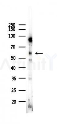 PAK1 Recombinant Rabbit mAb - Western blot analysis of lysates from Hela cells(LPS,4h treatment), using PAK1 Recombinant Rabbit mAb at 1/1000 dilution.