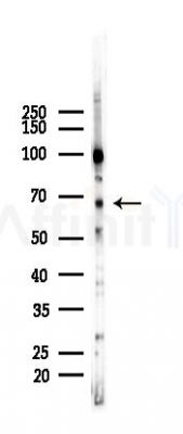 PAK1 Recombinant Rabbit mAb - Western blot analysis of lysates from Mouse testis, using PAK1 Recombinant Rabbit mAb at 1/1000 dilution.
