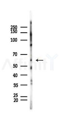 PAK1 Recombinant Rabbit mAb - Western blot analysis of lysates from Rat testis, using PAK1 Recombinant Rabbit mAb at 1/1000 dilution.