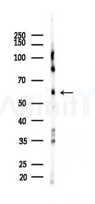 PAK1 Recombinant Rabbit mAb - Western blot analysis of lysates from 293 cells(heat-shock,45min treatment), using PAK1 Recombinant Rabbit mAb at 1/1000 dilution.