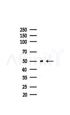 FKBP51 Recombinant Rabbit mAb - Western blot analysis of lysates from COLO205 cells(heat-shock,45min treatment), using FKBP51 Recombinant Rabbit mAb at 1/1000 dilution.