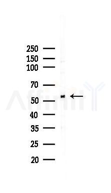 FKBP51 Recombinant Rabbit mAb - Western blot analysis of lysates from HUVEC cells(LPS,4h treatment), using FKBP51 Recombinant Rabbit mAb at 1/1000 dilution.