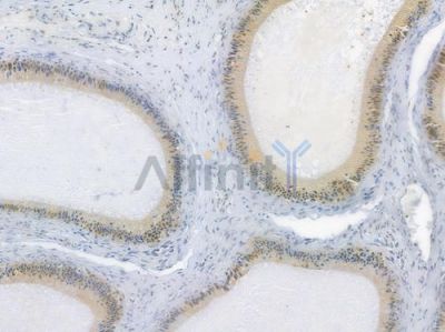 FKBP51 Recombinant Rabbit mAb - BF3793 at 1/100 staining human testicular cancer by IHC-P.