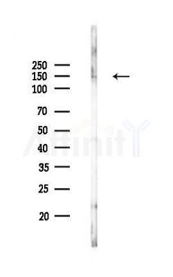 Raptor Recombinant Rabbit mAb - Western blot analysis of lysates from B16F10-LUC cells(LPS,4h treatment), using Raptor Recombinant Rabbit mAb at 1/1000 dilution.