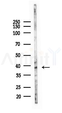 SIRT6 Recombinant Rabbit mAb - Western blot analysis of lysates from Mouse liver, using SIRT6 Recombinant Rabbit mAb at 1/1000 dilution.