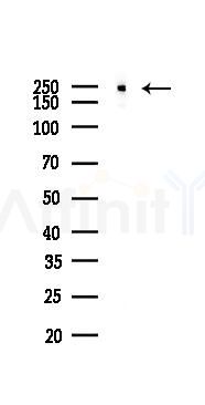 NOTCH4 Recombinant Rabbit mAb - Western blot analysis of lysates from LoVo cells(heat-shock,45min treatment), using NOTCH4 Recombinant Rabbit mAb at 1/1000 dilution.