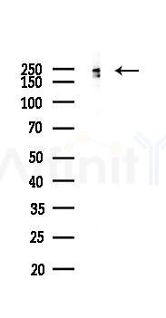 NOTCH4 Recombinant Rabbit mAb - Western blot analysis of lysates from EC304 cells(LPS, 4h treatment), using NOTCH4 Recombinant Rabbit mAb at 1/1000 dilution.